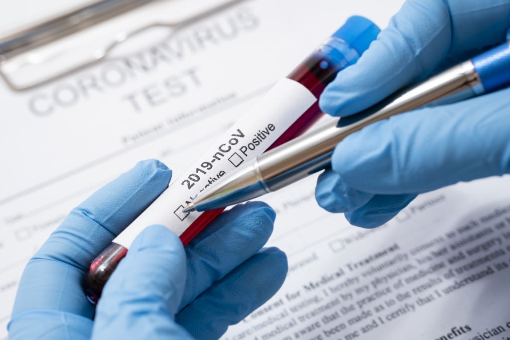 Koronavírus teszt Izlandon